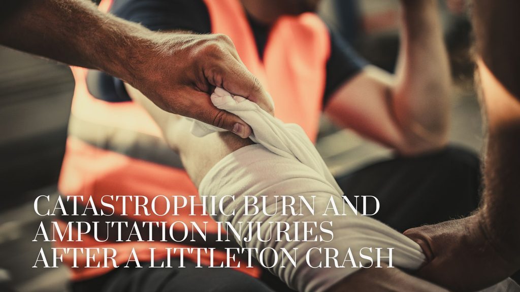 Catastrophic Burn and Amputation Injuries After a Littleton Crash